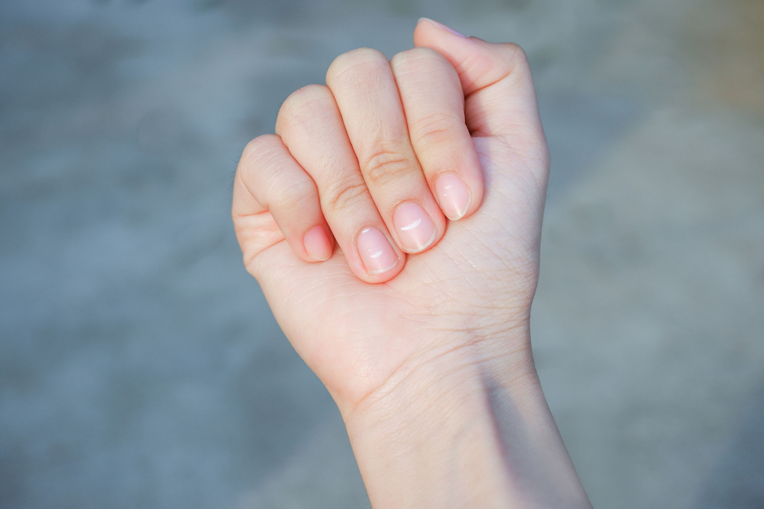 White spots on fingernails can be due to zinc or calcium deficiency in gluten intolerance