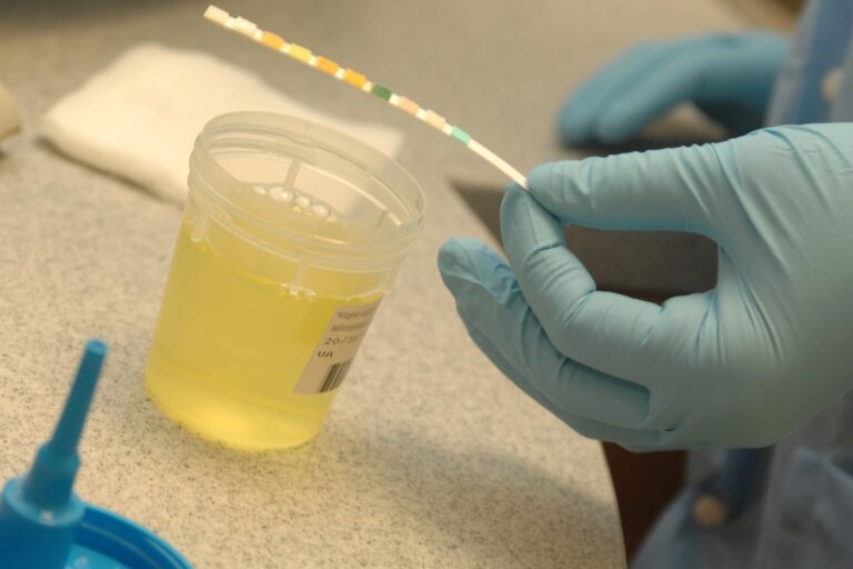 Una nueva prueba de orina para monitorear la exposición al gluten