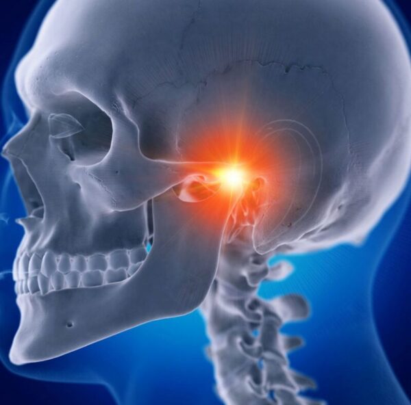 TMJ joint highlighted. Problems with this joint can contribute to headaches. There are ways to find TJM headache relief